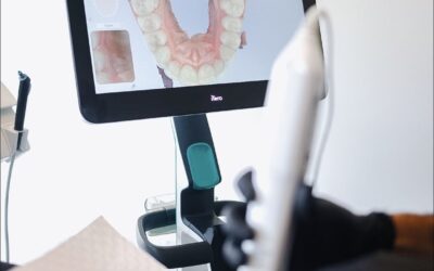 Ortodoncia invisible: lo que nadie te explica antes de empezar